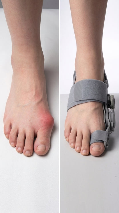 Solunia ™ Bunion Corrector